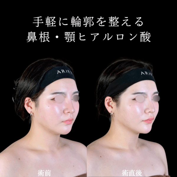 No.10006の症例写真