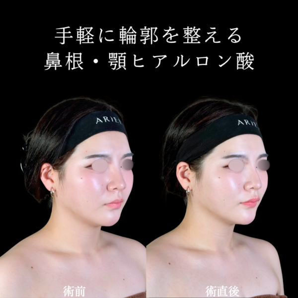 No.10006の症例写真 No.10006の症例写真