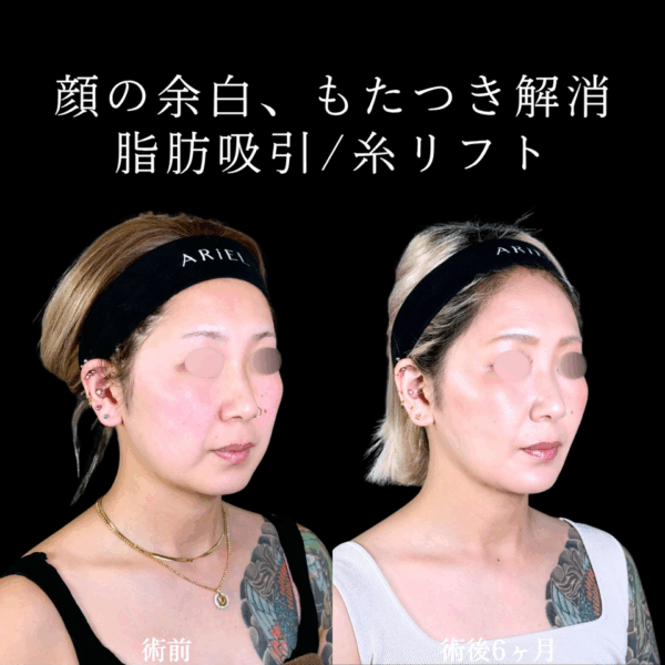 No.9990の症例写真 No.9990の症例写真