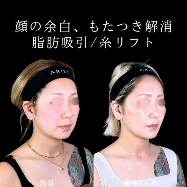 No.9990の症例写真 No.9990の症例写真