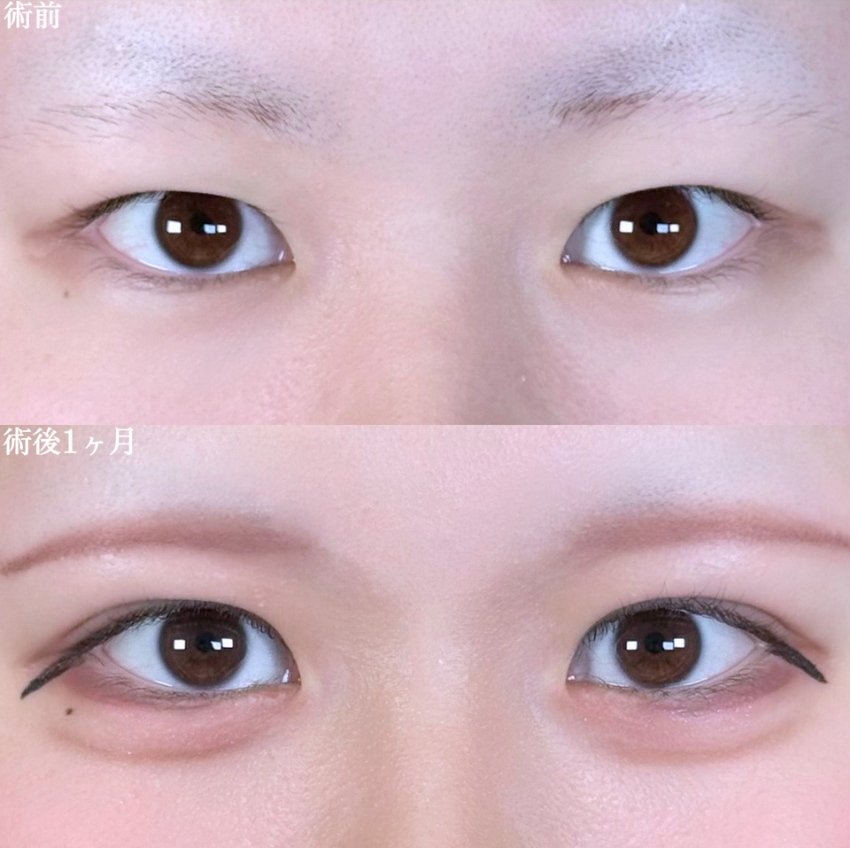 No.10058の症例写真