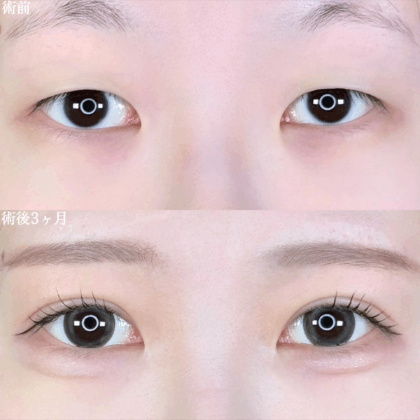 No.10067の症例写真 No.10067の症例写真