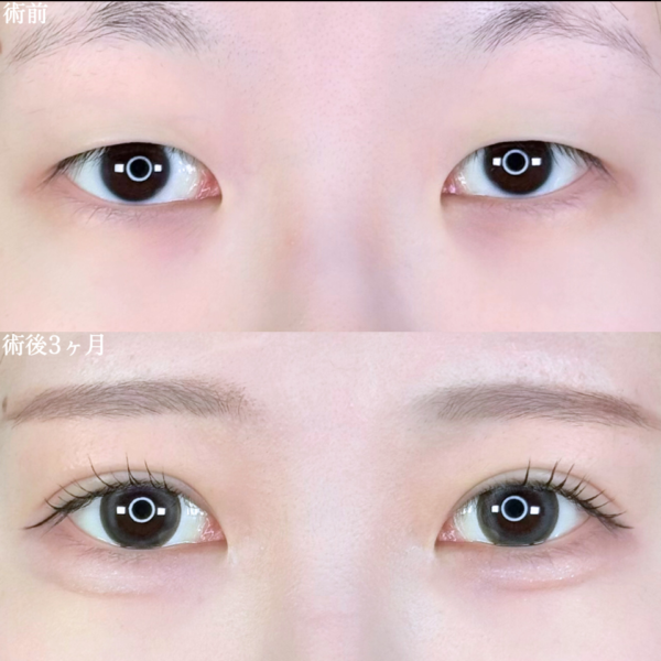 No.10067の症例写真 No.10067の症例写真