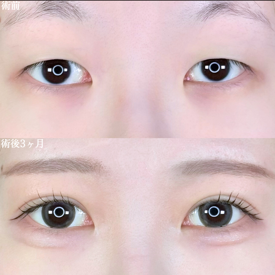 No.10067の症例写真