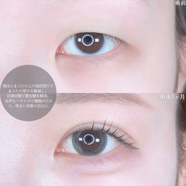 No.10010の症例写真 No.10010の症例写真