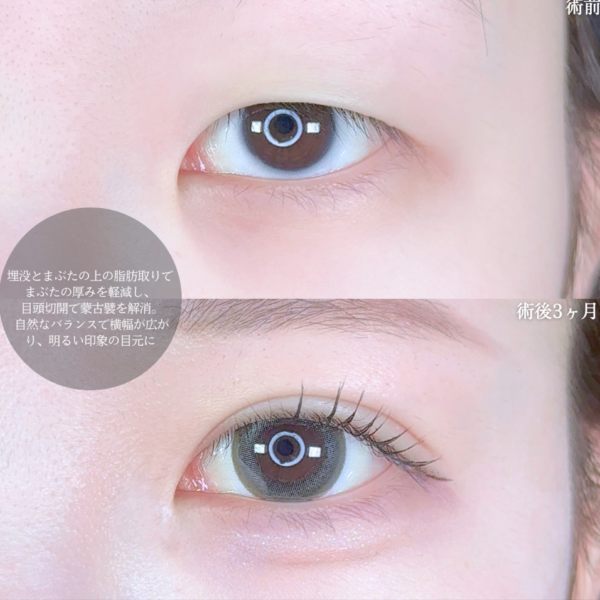 No.10010の症例写真 No.10010の症例写真