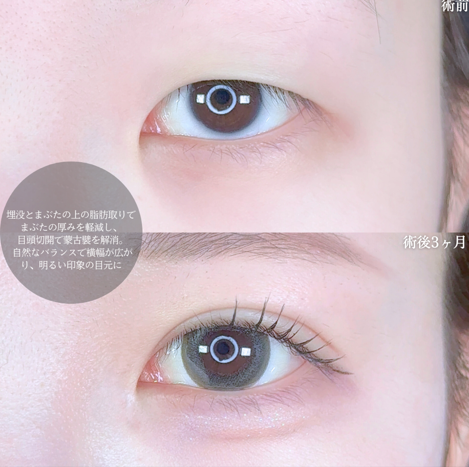 No.10010の症例写真