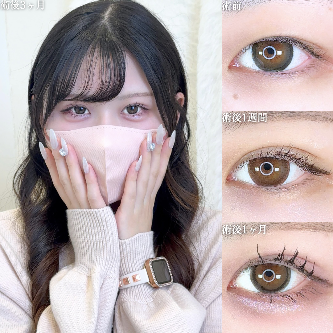 No.10262の症例写真