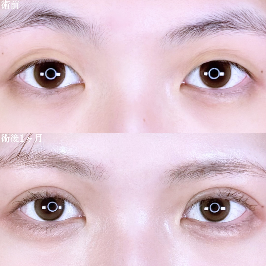 No.10291の症例写真