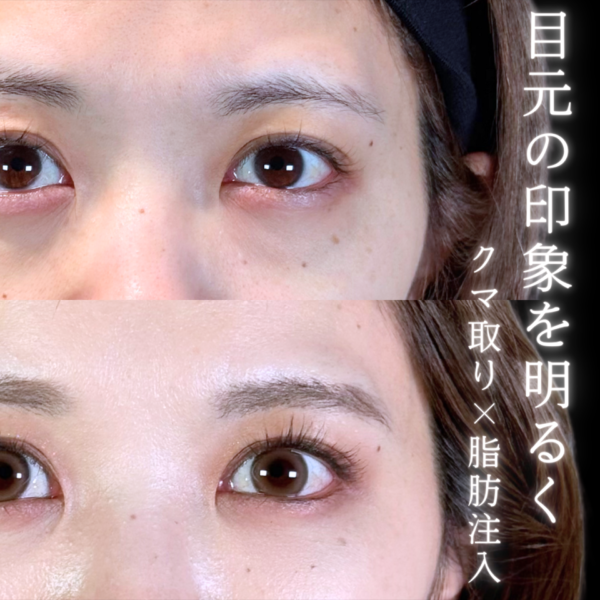 No.10178の症例写真 No.10178の症例写真