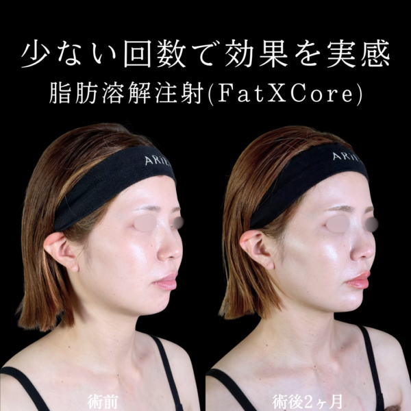 No.10277の症例写真