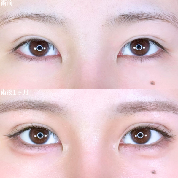 No.10175の症例写真 No.10175の症例写真