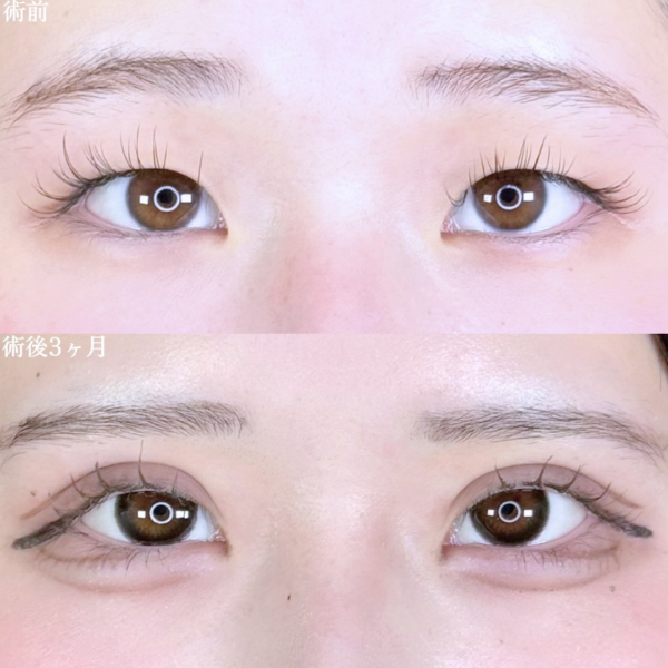 No.10272の症例写真