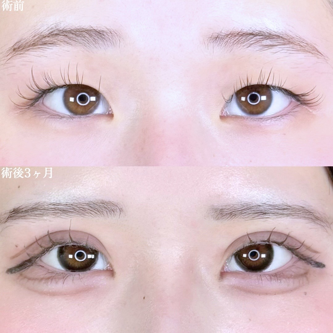 No.10272の症例写真