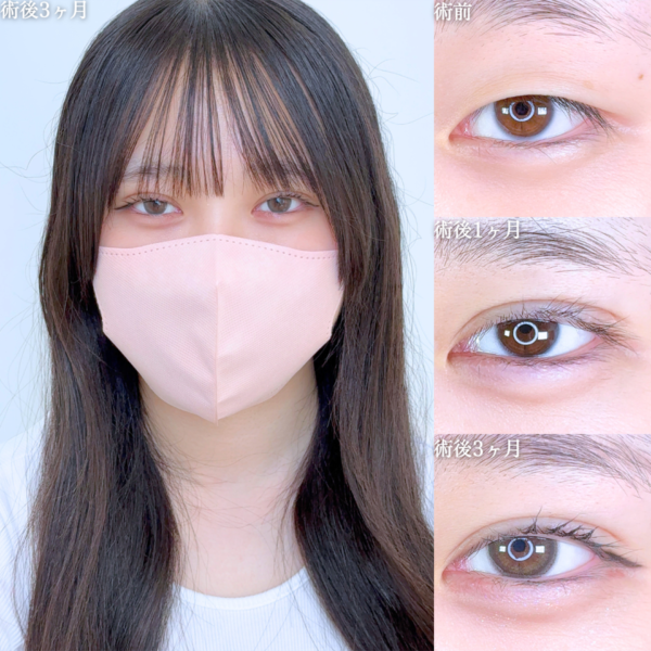 No.10167の症例写真 No.10167の症例写真