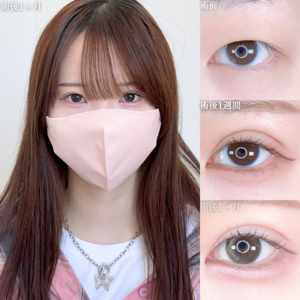 No.10287の症例写真 No.10287の症例写真