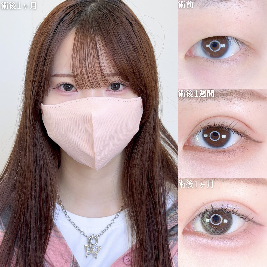 No.10287の症例写真