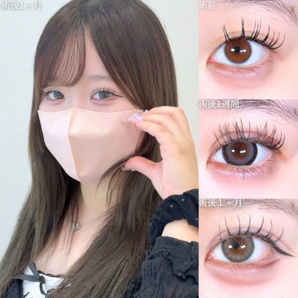 No.10153の症例写真 No.10153の症例写真