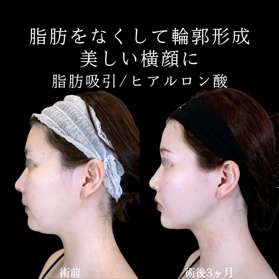 No.10318の症例写真