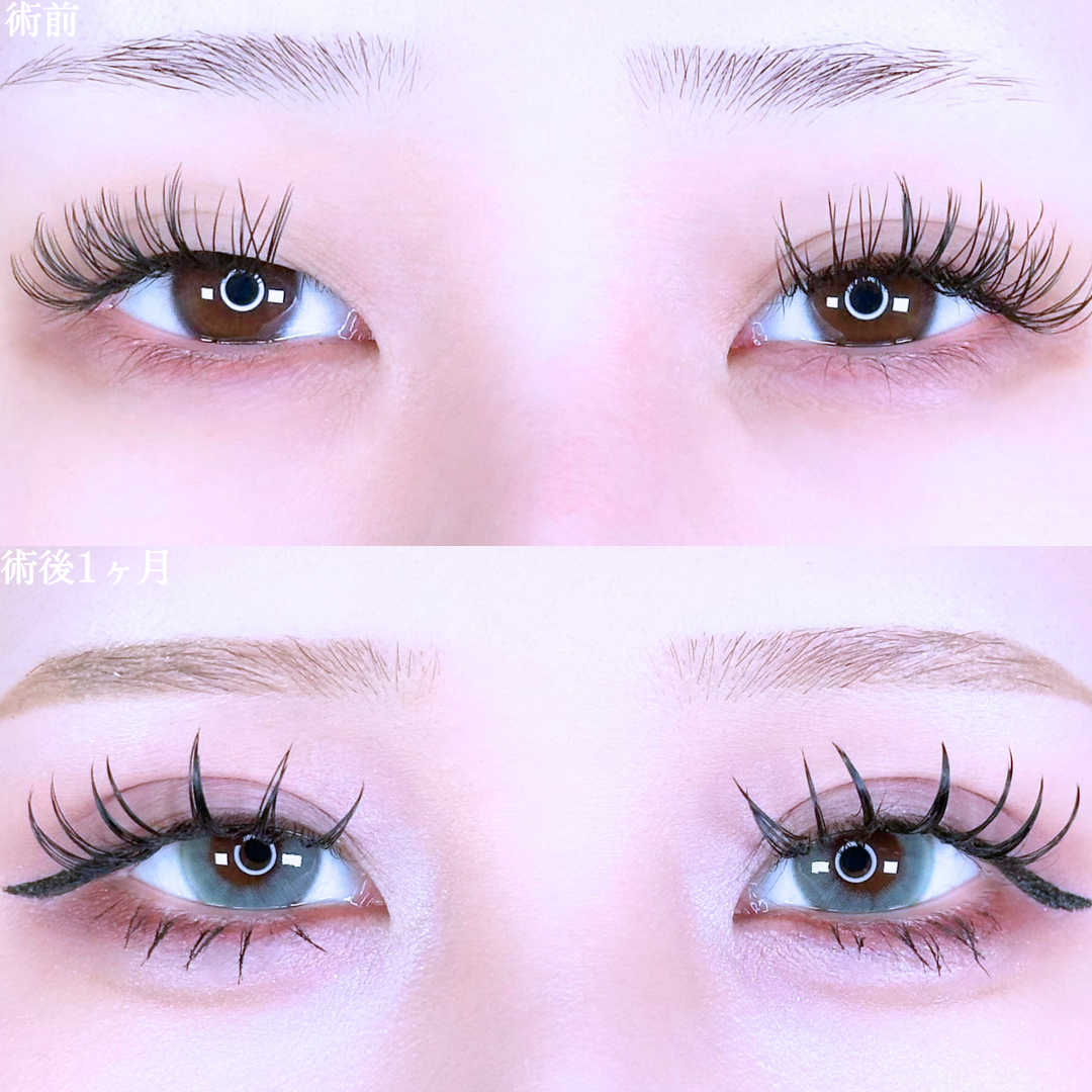 No.10738の症例写真