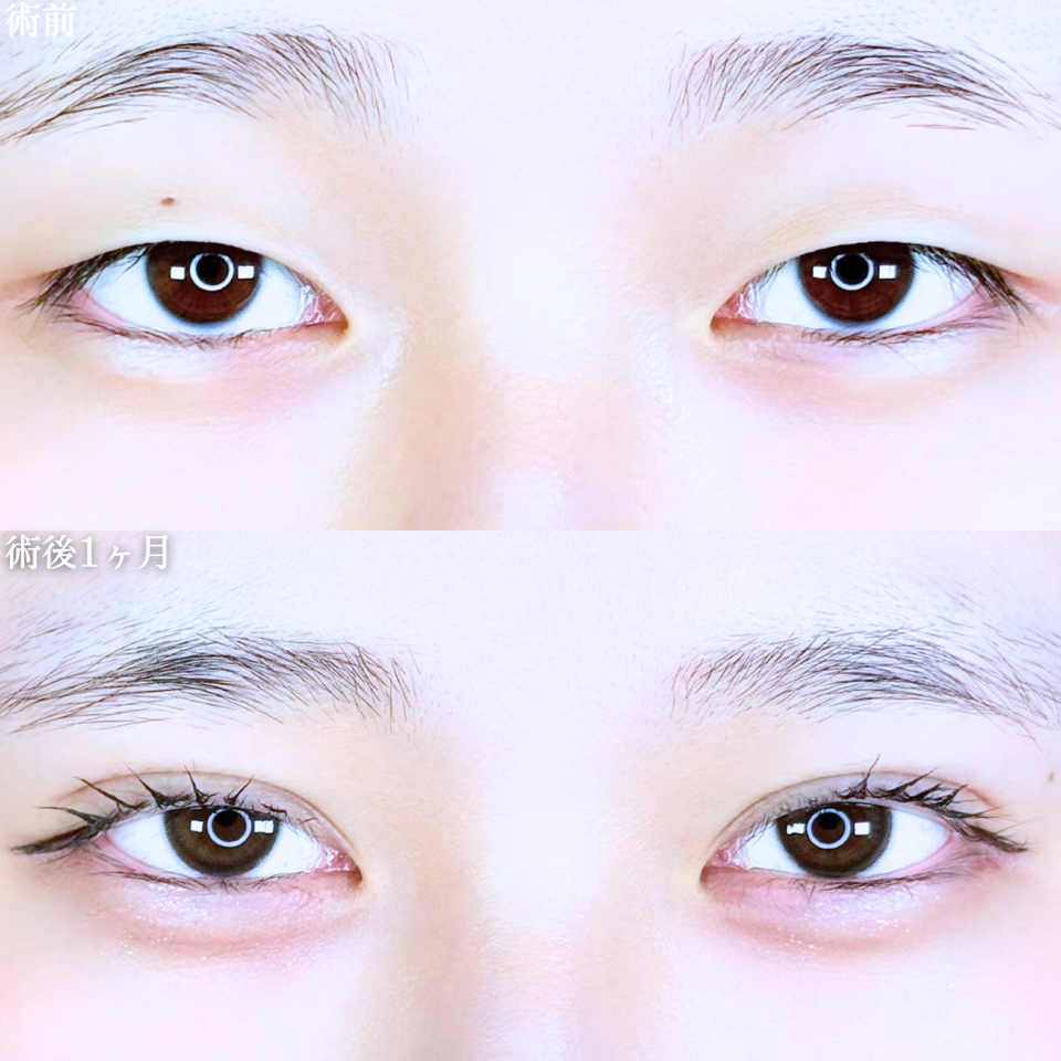 No.10790の症例写真