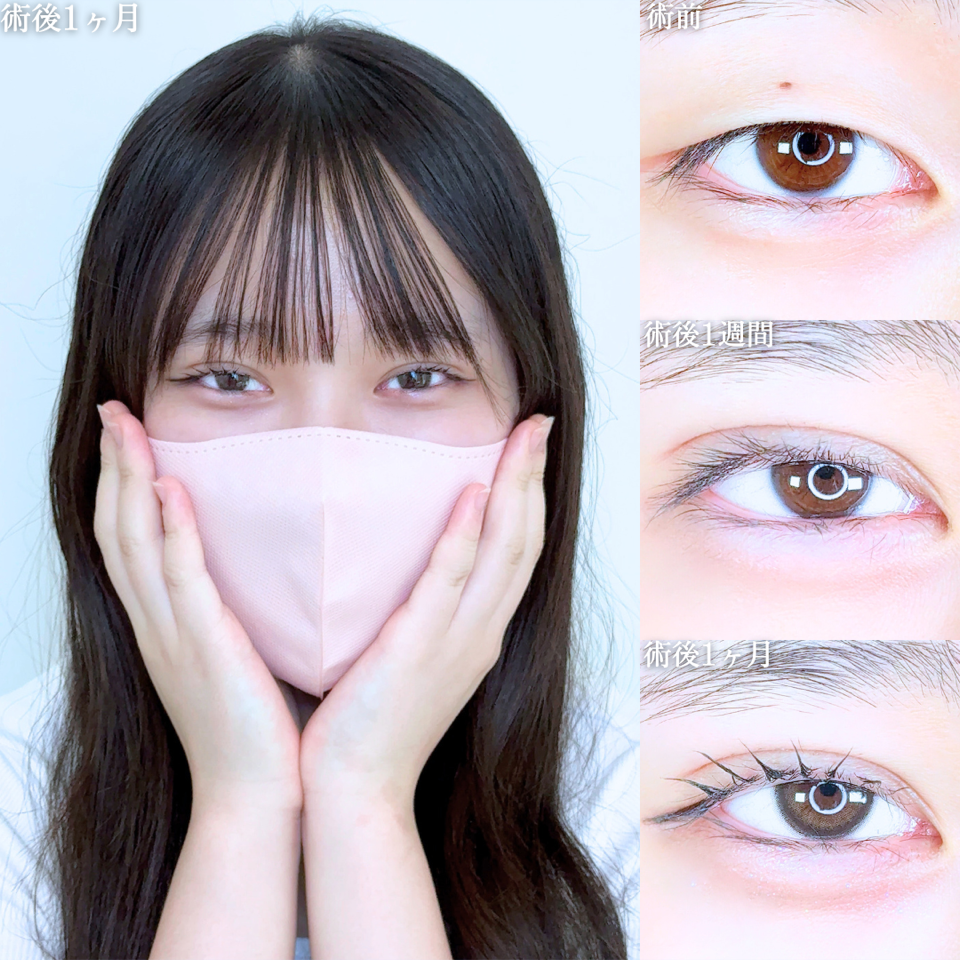 No.10784の症例写真