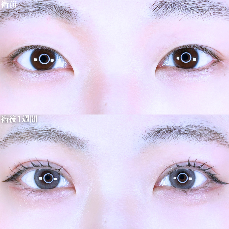 No.11001の症例写真