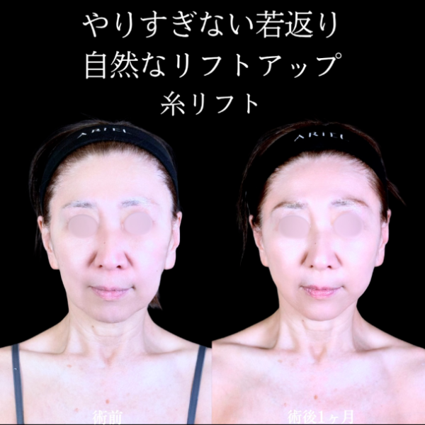 No.10992の症例写真