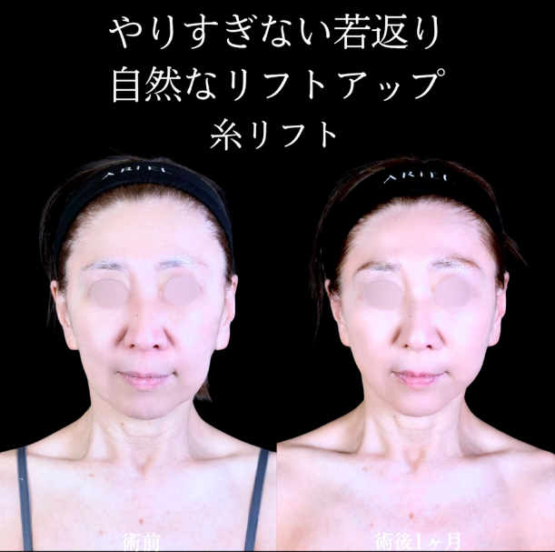 No.10992の症例写真