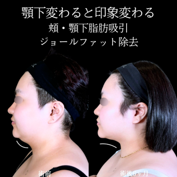 No.10899の症例写真