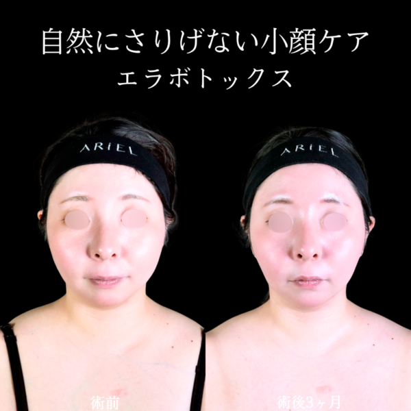 No.10566の症例写真 No.10566の症例写真