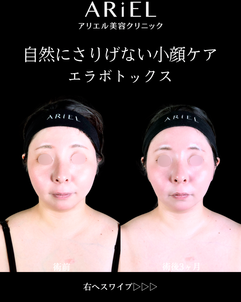 No.10566の症例写真