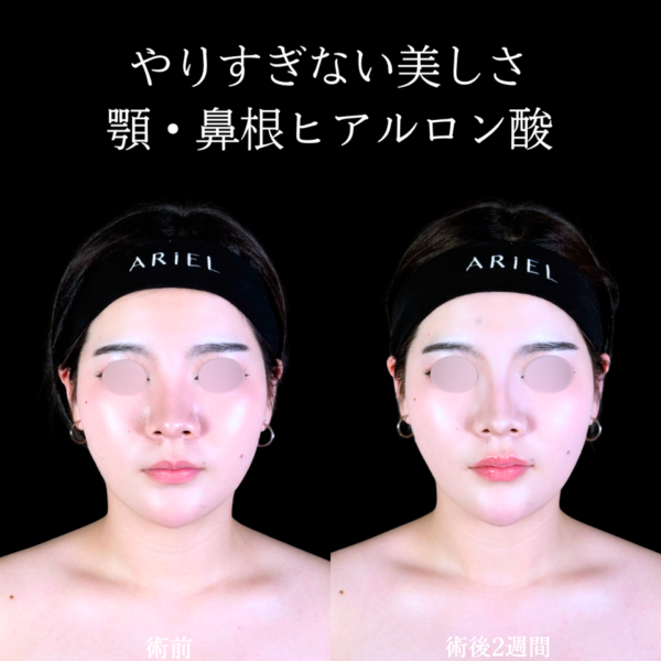 No.10808の症例写真 No.10808の症例写真