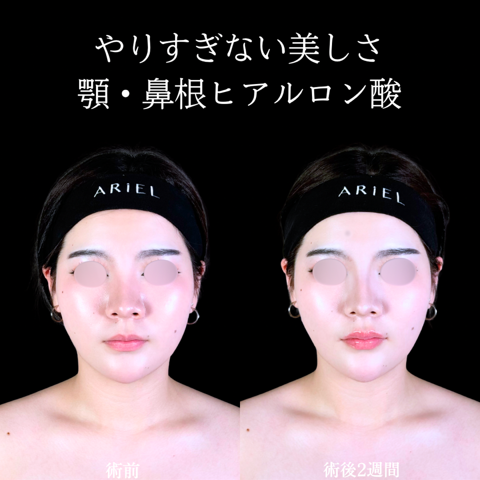 No.10808の症例写真