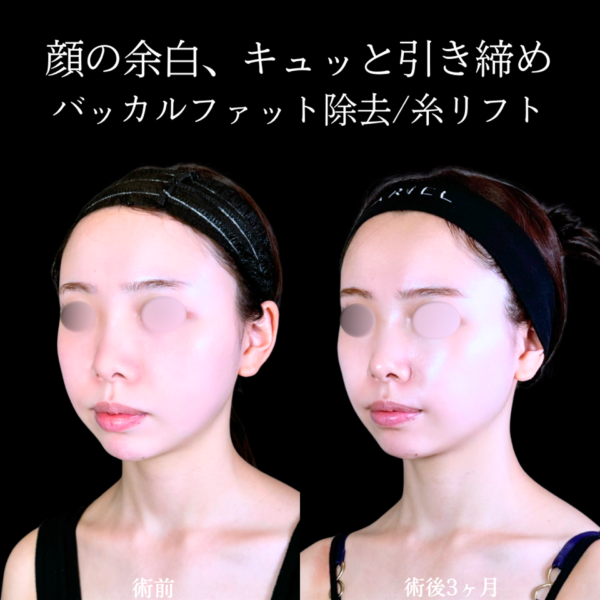 No.10603の症例写真