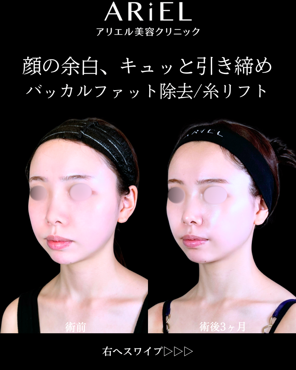 No.10603の症例写真