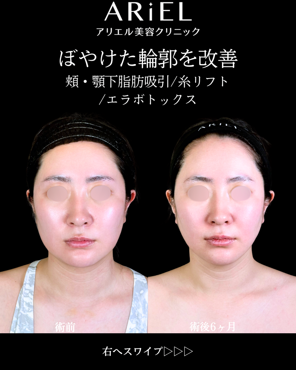 No.10651の症例写真