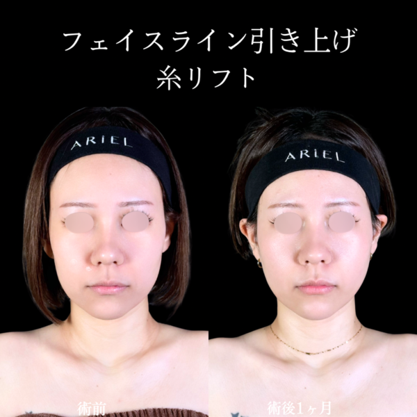 No.10692の症例写真