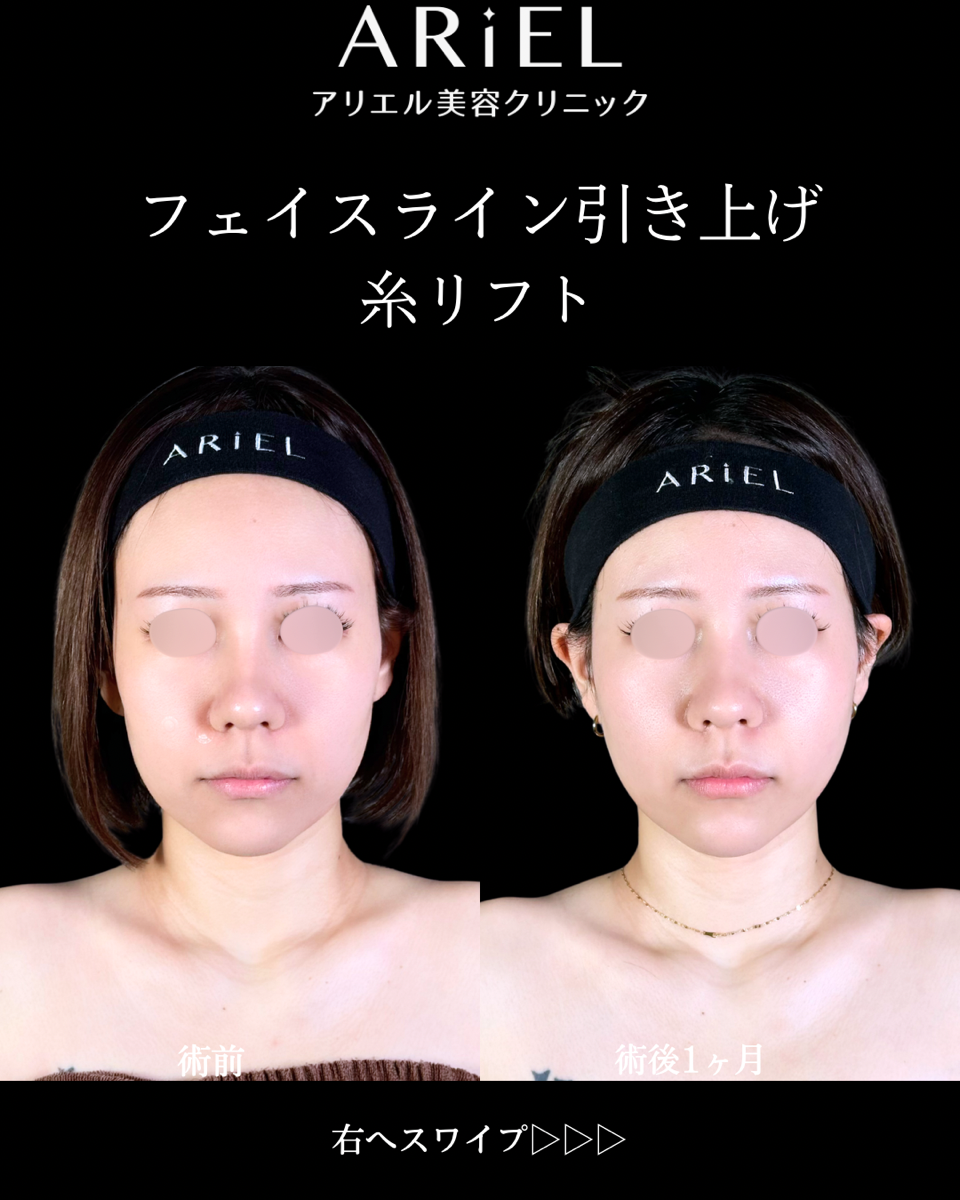 No.10692の症例写真