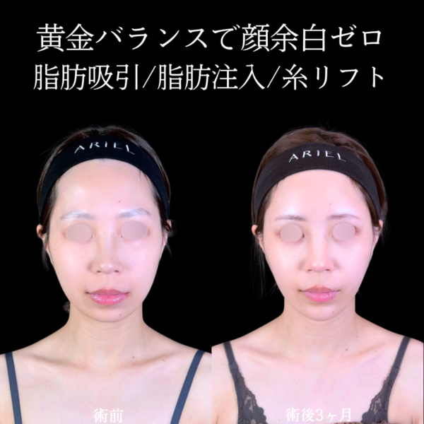 No.11010の症例写真