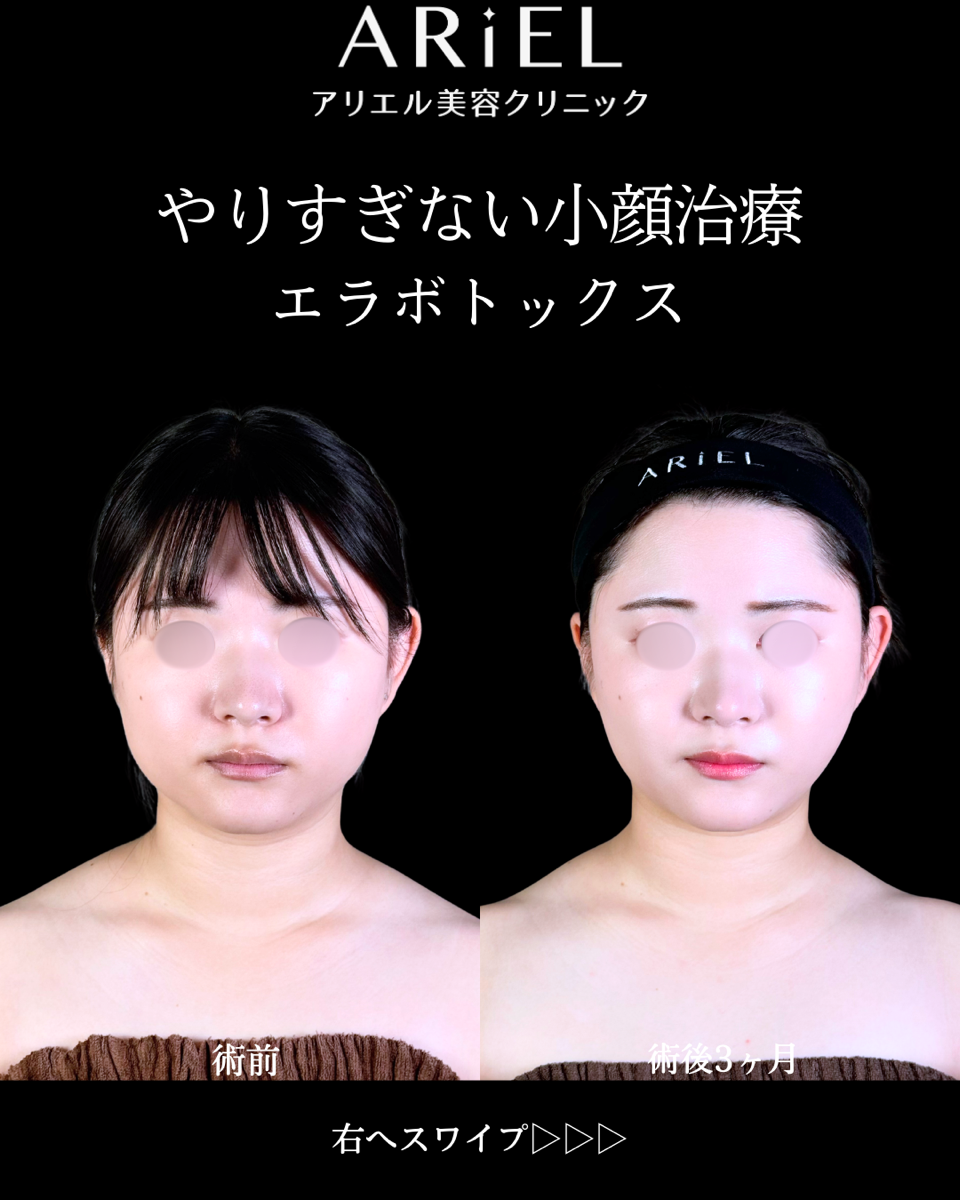 No.10523の症例写真