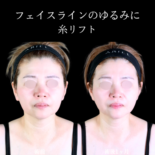 No.10572の症例写真 No.10572の症例写真