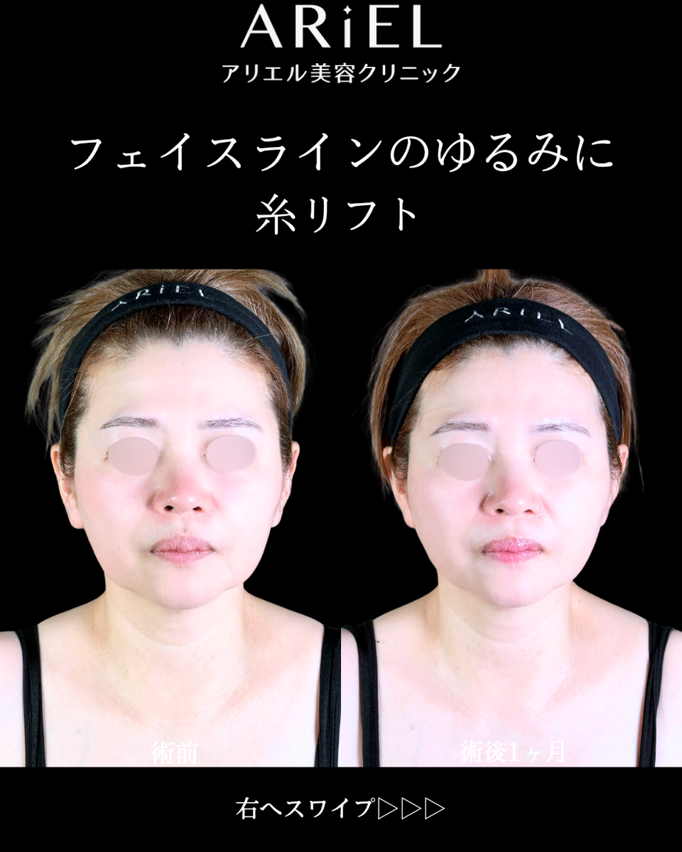 No.10572の症例写真