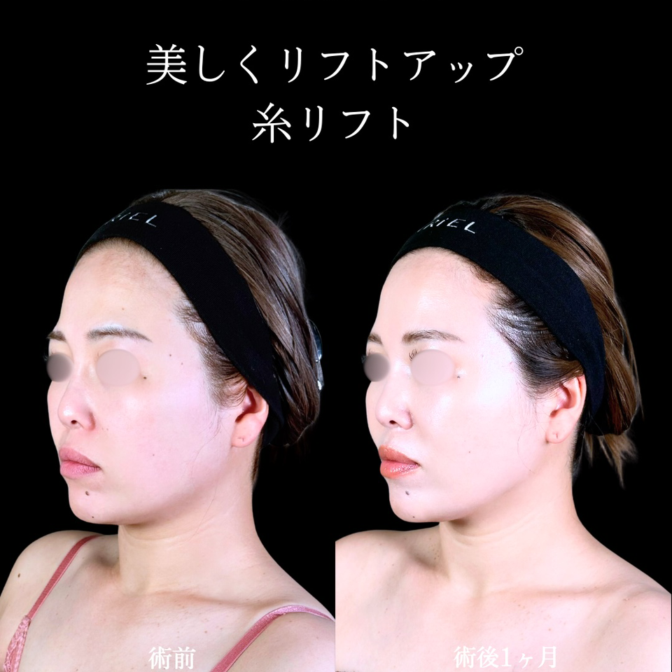 No.10887の症例写真