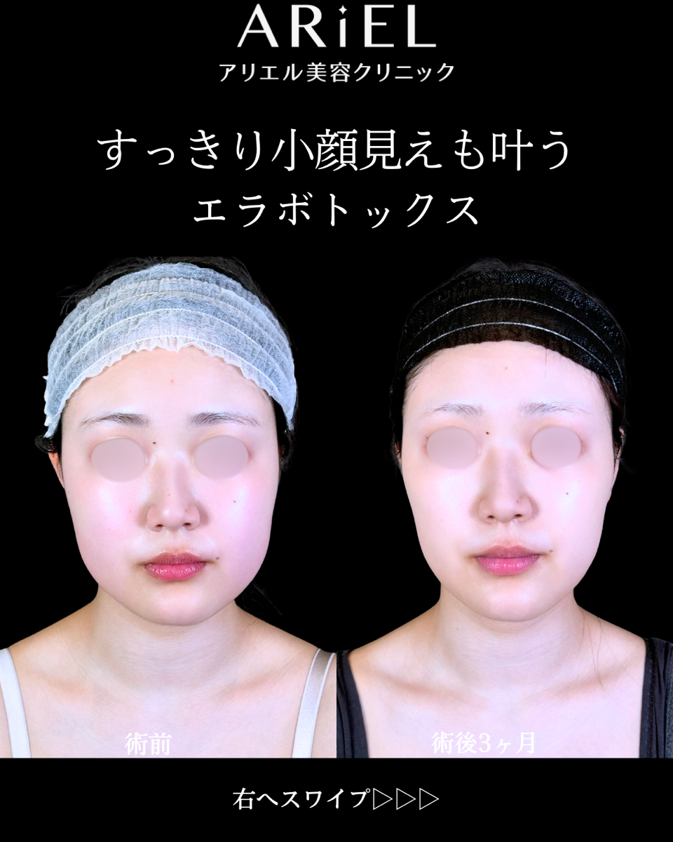 No.10615の症例写真