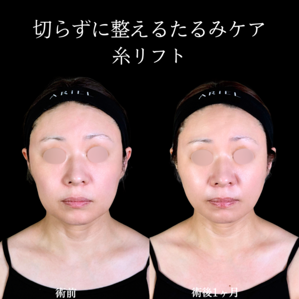 No.10657の症例写真 No.10657の症例写真