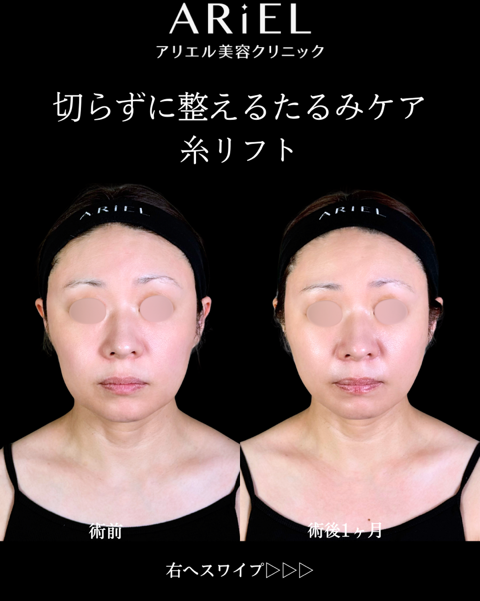 No.10657の症例写真