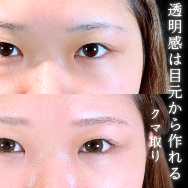 No.10680の症例写真