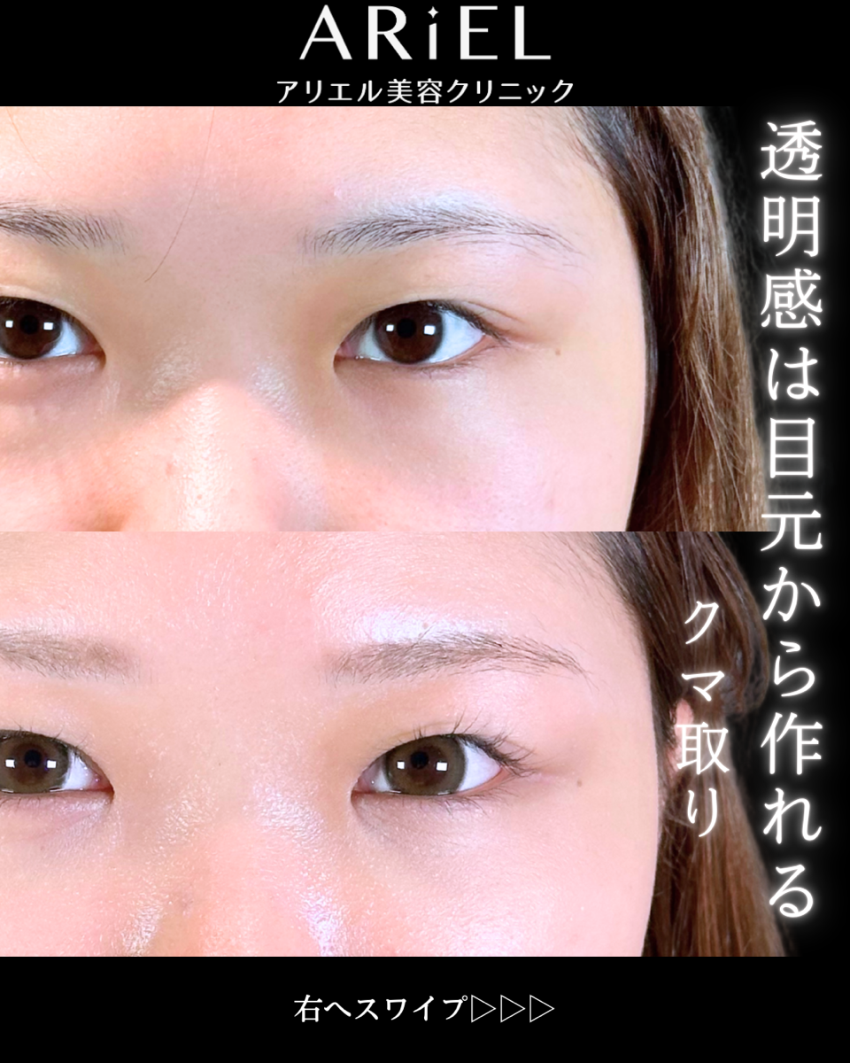 No.10680の症例写真