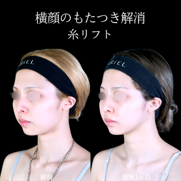 No.10802の症例写真 No.10802の症例写真